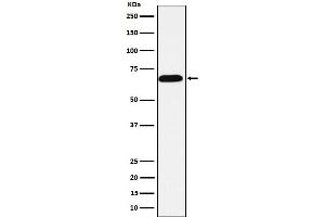Western blot analysis of intestinal alkaline phosphatase expression in HeLa cell lysate. (Recombinant Alkaline Phosphatase 抗体)