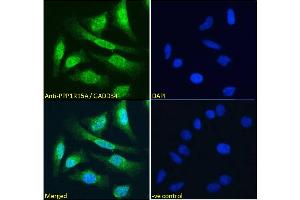 Immunofluorescence (IF) image for anti-Protein Phosphatase 1, Regulatory (Inhibitor) Subunit 15A (PPP1R15A) (C-Term) antibody (ABIN184571)