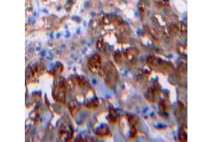 IHC-P analysis of Kidney tissue, with DAB staining. (Leptin 抗体  (AA 22-167))