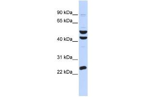 WB Suggested Anti-ZNF200 Antibody Titration:  0. (ZNF200 抗体  (Middle Region))