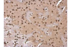 IHC Image SOD1 antibody detects SOD1 protein at cytosol on mouse fore brain by immunohistochemical analysis. (SOD1 抗体)