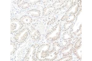 Immunohistochemistry (IHC) image for anti-Protein Phosphatase 1, Catalytic Subunit, gamma Isoform (PPP1CC) (C-Term) antibody (ABIN7454685)