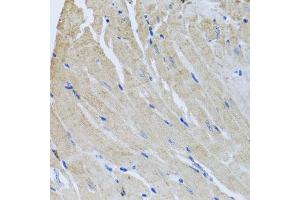 Immunohistochemistry of paraffin-embedded mouse heart using SRI antibody  at dilution of 1:100 (40x lens). (SRI 抗体  (AA 1-198))