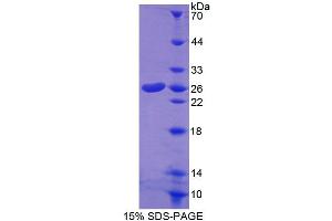SDS-PAGE analysis of Mouse CORT Protein. (CROT 蛋白)