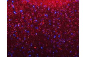 IF analysis of RIMBP2 using anti-RIMBP2 antibody (ABIN7601441). (RIMBP2 抗体  (AA 351-1049))