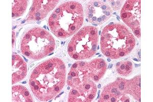 DBT antibody was used for immunohistochemistry at a concentration of 4-8 ug/ml. (DBT 抗体  (N-Term))