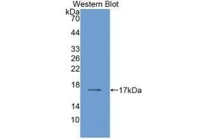 Detection of Recombinant RBP2, Human using Monoclonal Antibody to Retinol Binding Protein 2, Cellular (RBP2) (RBP2 抗体  (AA 1-134))