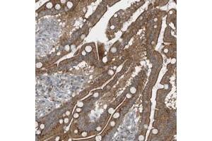 Immunohistochemical staining of human duodenum with GCC2 polyclonal antibody  shows moderate cytoplasmic and membranous positivity in glandular cells at 1:200-1:500 dilution.