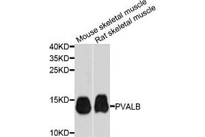 Western blot analysis of extracts of mouse skeletal muscle cells, using PVALB antibody. (PVALB 抗体)