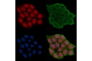 Phospho-MAP3K4 (Ser499) Antibody staining Hela cells(45 min of heat-shock treatment) by IF/ICC. (MAP3K4 抗体  (pSer499))