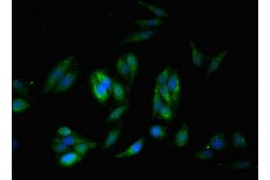 Immunofluorescent analysis of Hela cells using ABIN7171205 at dilution of 1:100 and Alexa Fluor 488-congugated AffiniPure Goat Anti-Rabbit IgG(H+L) (SYNM 抗体  (AA 1147-1417))