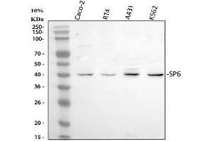 Western blot analysis of SP6 using anti-SP6 antibody (ABIN5692945). (SP6 抗体)