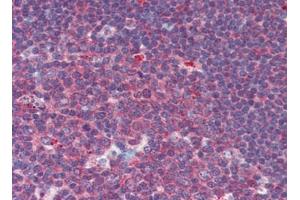 Human Tonsil: Formalin-Fixed, Paraffin-Embedded (FFPE) (CUEDC2 抗体  (C-Term))
