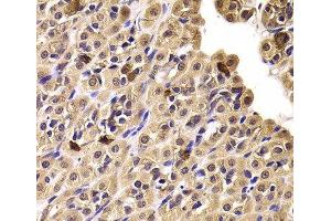 Immunohistochemistry of paraffin-embedded Rat stomach using CCT4 Polyclonal Antibody at dilution of 1:100 (40x lens). (CCT4 抗体)