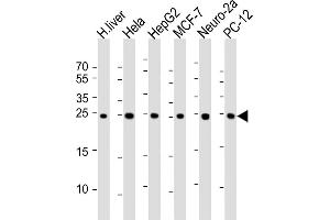 Western Blotting (WB) image for anti-Proteasome Subunit alpha 5 (PSMA5) antibody (ABIN1539887)