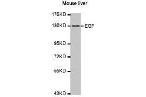 Western Blotting (WB) image for anti-Epidermal Growth Factor (EGF) antibody (ABIN1872450) (EGF 抗体)