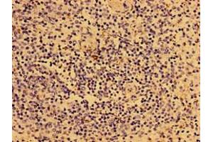 Immunohistochemistry of paraffin-embedded human spleen tissue using ABIN7149294 at dilution of 1:100 (IL2RG 抗体  (AA 75-230))