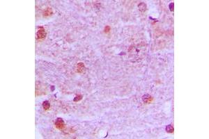 Immunohistochemical analysis of MRE11 staining in human brain formalin fixed paraffin embedded tissue section. (Mre11 抗体  (Center))