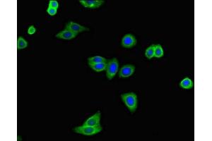 Immunofluorescent analysis of HepG2 cells using ABIN7144789 at dilution of 1:100 and Alexa Fluor 488-congugated AffiniPure Goat Anti-Rabbit IgG(H+L) (Ataxin 2 抗体  (AA 174-383))