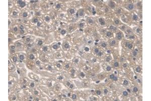Detection of SPTLC1 in Mouse Liver Tissue using Polyclonal Antibody to Serine Palmitoyltransferase, Long Chain Base Subunit 1 (SPTLC1) (SPTLC1 抗体  (AA 143-473))