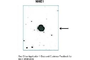 DB Suggested Anti-Nme1 antibody  Titration: 0. (NME1 抗体  (C-Term))