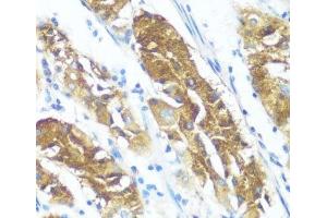 Immunohistochemistry of paraffin-embedded Human stomach using NME3 Polyclonal Antibody at dilution of 1:100 (40x lens). (NME3 抗体)