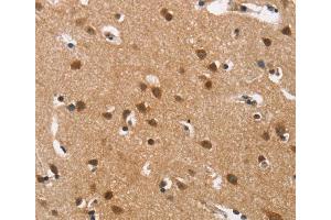 Immunohistochemistry (IHC) image for anti-Calcium Channel, Voltage-Dependent, L Type, alpha 1D Subunit (CACNA1D) antibody (ABIN5549743) (CACNA1D 抗体)