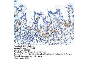 Rabbit Anti-CSH1 Antibody  Paraffin Embedded Tissue: Human Stomach Cellular Data: Epithelial cells of fundic gland Antibody Concentration: 4. (CSH1 抗体  (Middle Region))