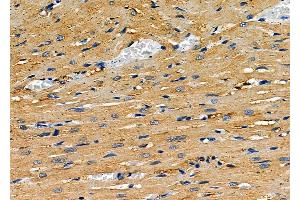 ABIN6264030 and ABIN6277904 at 1/100 staining Rat heart tissue by IHC-P.