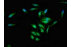 Immunofluorescent analysis of Hela cells using ABIN7157016 at dilution of 1:100 and Alexa Fluor 488-congugated AffiniPure Goat Anti-Rabbit IgG(H+L) (Involucrin 抗体  (AA 24-118))