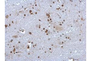 IHC-P Image HMGB1 antibody detects HMGB1 protein at nucleus on rat brain stem by immunohistochemical analysis. (HMGB1 抗体)