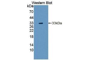 Western blot analysis of the recombinant protein. (TAT 抗体  (AA 221-454))