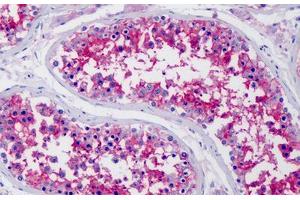 Human Testis: Formalin-Fixed, Paraffin-Embedded (FFPE) (CD147 抗体  (N-Term))