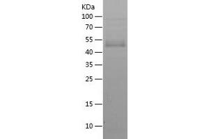 Western Blotting (WB) image for Zinc Finger E-Box Binding Homeobox 1 (ZEB1) (AA 1-230) protein (His tag) (ABIN7282839) (ZEB1 Protein (AA 1-230) (His tag))