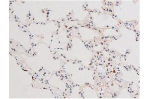 Immunohistochemistry (IHC) image for anti-Forkhead Box O4 (FOXO4) (pThr451) antibody (ABIN6256565)