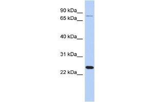 WB Suggested Anti-RPS7 Antibody Titration: 0. (RPS7 抗体  (Middle Region))