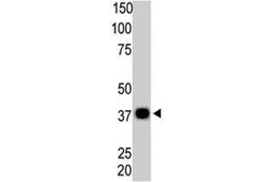The PPP6C polyclonal antibody  is used in Western blot to detect PPP6C in Thymus tissue lysate. (PPP6C 抗体  (N-Term))