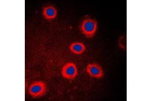 Immunofluorescent analysis of Adenylate Cyclase 9 staining in HeLa cells. (ADCY9 抗体  (N-Term))