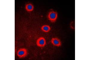 Immunofluorescent analysis of Adenylate Cyclase 9 staining in HeLa cells. (ADCY9 抗体  (N-Term))