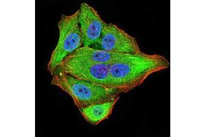 Immunocytochemistry (ICC) image for anti-Neurofilament Triplet M Protein (NEFM) (AA 779-916) antibody (ABIN5872897) (NEFM 抗体  (AA 779-916))