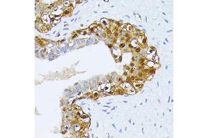 Immunohistochemistry (IHC) image for anti-Survival of Motor Neuron 1, Telomeric (SMN1) (AA 80-150) antibody (ABIN7270652)