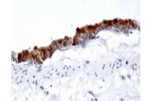 Immunohistochemistry using DAB substrate showing intense staining in the rat airway epithelium using AP1G1 polyclonal antibody  at a dilution of 1 : 500. (gamma 1 Adaptin 抗体  (AA 5-24))