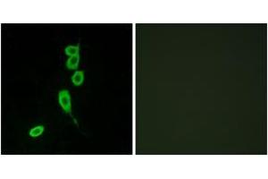 Immunofluorescence analysis of LOVO cells, using MSHR Antibody. (MC1 Receptor 抗体  (AA 268-317))