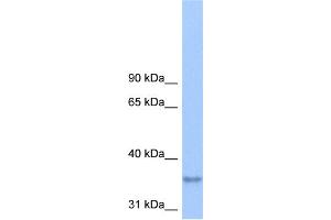 WB Suggested Anti-LPPR2 Antibody Titration:  0. (LPPR2 抗体  (Middle Region))