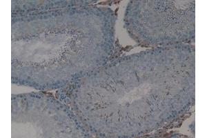 Detection of MX1 in Rat Testis Tissue using Polyclonal Antibody to Myxovirus Resistance 1 (MX1) (MX1 抗体  (AA 68-303))