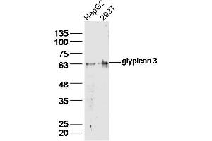 Lane 1: HepG2 lysates Lane 2: 293T lysates probed with glypican 3 Polyclonal Antibody, Unconjugated  at 1:300 dilution and 4˚C overnight incubation. (Glypican 3 抗体  (AA 201-300))