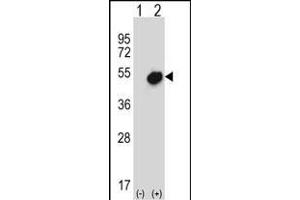 Western blot analysis of NR0B1 (arrow) using rabbit polyclonal NR0B1 Antibody (Center) (ABIN657696 and ABIN2846687).