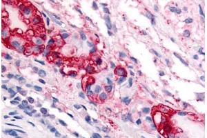 Immunohistochemistry (Paraffin-embedded Sections) (IHC (p)) image for anti-Corticotropin Releasing Hormone Receptor 1 (CRHR1) (N-Term) antibody (ABIN213513)