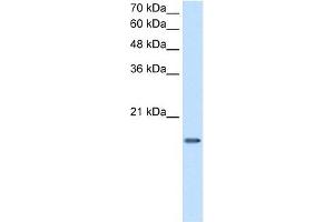 DUT antibody used at 2. (Deoxyuridine Triphosphatase (DUT) (C-Term) 抗体)