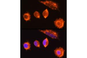 Immunofluorescence analysis of L929 cells using MG Rabbit pAb (ABIN6132348, ABIN6143808, ABIN6143810 and ABIN6222011) at dilution of 1:100 (40x lens). (MGAT1 抗体  (AA 156-445))